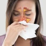 Gejala Sinusitis